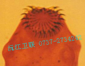 豬帶絳蟲(chóng)頭節